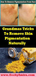 17 Grandmas Tricks To Remove Skin Pigmentation Naturally Cleaning How To Remove Cleaning Hacks pinterest