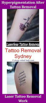 Pin On Tattoo Removal