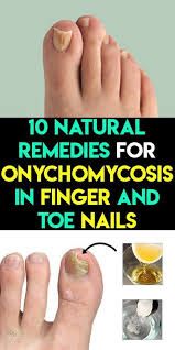 10 Natural Remedies For Onychomycosis In Finger And Toe Nails Keto Slim Reviews Natural Remedies Toe Nails Onychomycosis