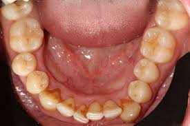 Are you looking for a family dentist you can trust? Dentist In Croydon Gentle Dental Care