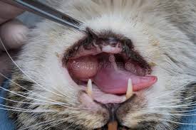 White patches are called leukoplakia. 429 Oral Cancer Photos Free Royalty Free Stock Photos From Dreamstime