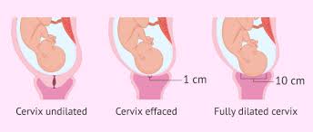 Image result for cervix position