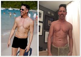 Back next discussion poland syndrome is a sporadic, congenital condition with a wide spectrum of presentation. Plastic Surgery For Men Why Butt And Pec Implants Are On The Rise