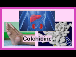 Image result for Colchicine Toxicity