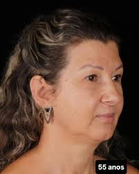 Não é só estética. É autoestima. É se olhar e se reconhecer,  linda,forte,confiante.🤍✨ 🔺De acordo com as resoluções 196/2019 e federal  5081/66. 🔺As imagens foram autorizadas pelo paciente, e ilustram um caso