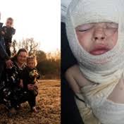 So dapper ná ondenkbare hartseer: 12-jarige se merkwaardige herstel ná  ongeluk haar pa eis