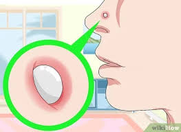 Apply the gel at least twice a day. 3 Ways To Get Rid Of A Nose Ring Bump Wikihow