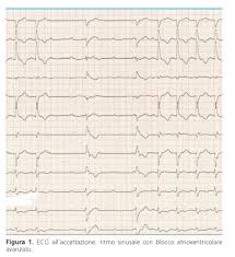 A duração da doença pode variar de horas a meses. Covid 19 E Coinvolgimento Cardiaco Una Presentazione Inusuale Giornale Italiano Di Cardiologia Organo Ufficiale Di Italian Federation Of Cardiology E Societa Italiana Di Chirurgia Cardiaca