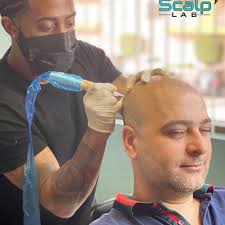 TOP 10 BEST Scalp Treatment in Thousand Oaks, CA