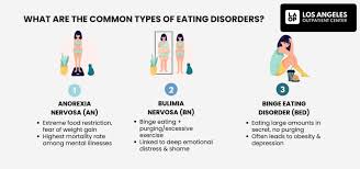 Image result for Binge-Eating Disorder