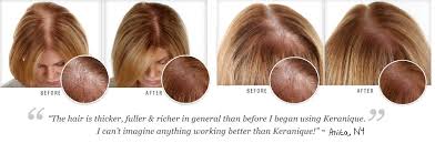 Dr oz guides shows you how to have healthy hair and be beautiful. Keranique Hair Regrowth Solution For Women Start Fighting Hair Loss Today With Keranique Hair Regrowth As Seen On The Dr Oz Show