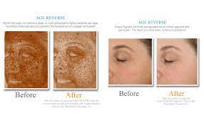 The exuviance peel is also one of the brand's best selling products. Amazon Com Age Reverse Bioactiv Wash Premium Beauty