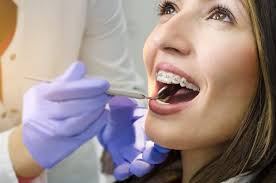 But braces aren't just for kids! Do I Need Braces If My Teeth Are Straight South Surrey Smiles