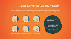 This can help you detect signs of breast cancer early. Breast Cancer Symptoms In Men What To Look Out For Hello