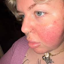 Free piercing spray and discount