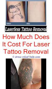 Tattoo Eraser Picosure Tattoo Removal Tattoo Removal Results Tattoo Removal Cost