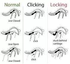 Here are seven possible c. What Can Cause Your Jaw To Become Locked Shut Quora