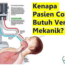 A mechanical ventilator is a machine that helps a patient breathe (ventilate) when they are having surgery or cannot breathe on their own due to a critical illness. Pasien Corona Butuh Ventilator Mekanik Apa Fungsinya