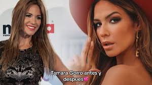 El Antes Y Después De Tamara