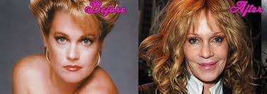 That she underwent cosmetic surgery to . Melanie Griffith S Plastic Surgery Mistakes Pictures
