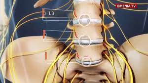 Hernia De Disc Youtube
