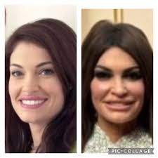 Awful plastic surgery is what happened. I feel sorry for her, she's ruined  her looks, which is likely the only thing she had going for her.