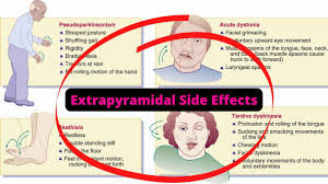 Image result for Extrapyramidal Side Effect