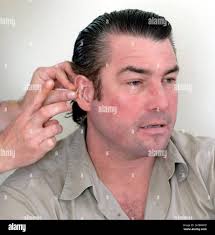 TV chef Ross Burden undergoing an acupuncture procedure at the Hale clinic  in London with Nick Dalton Brewer Stock Photo