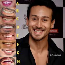 Identify the teeth? 99/ fail!