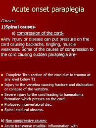 Check spelling or type a new query. Acute Onset Paraplegia Ppt