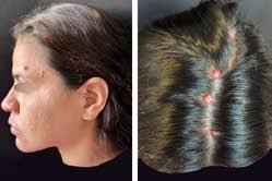 Órgano de la Sociedad Mexicana de Dermatología y de la Academia Mexicana de  Dermatología www.nietoeditores.com.mx