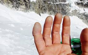 Reinhold messner is a famous mountaineer, explorer, and adventurer from italy. Frostbeulen Mussen Nicht Sein Schweizer Alpen Club Sac