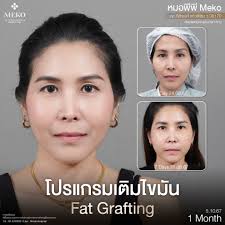 🎉 บิ๊กเซอร์ไพรส์ เผยโฉมใหม่ "คุณดวงดาว จารุจินดา" สวยสง่าส่งท้ายปี ✨  คุณดวงดาว มาทำอะไรที่ 𝐌𝐄𝐊𝐎 ? ดูจากรอยยิ้มเดาได้ไม่ยาก  ให้โพสต์นี้เป็นคำใบ้ 👀 #หมอเอิงMeko พญ. สุชีรา ศรัณย์เกตุ (ว.41242)  จักษุแพทย์ (Oculoplastic and Reconstructive Surgery ...