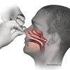 The common early symptom is a persistent hoarse voice. 1