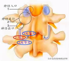 Cervical spondylosis is also known as cervical osteoarthritis or cervical spondylosis. Suffering From Cervical Spondylosis Why Do You Get Numbness In Your Hands Is The Herniated Cervical Disc Compressing The Nerve One Article To Tell You In Detail Inews