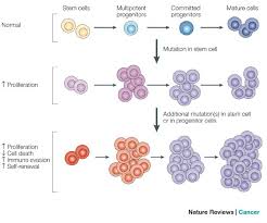 It starts in the tissues that make blood cells such as the bone marrow. Tumour Stem Cells And Drug Resistance Nature Reviews Cancer