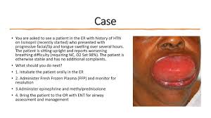 Image result for Angioedema