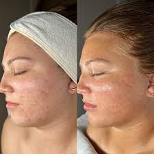 Touch & Glow Esthetics added a...