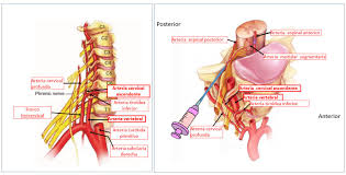 La columna cervical está compuesta por siete vértebras y discos intervertebrales y el desgaste. Nervios Cervicales O Nervios Raquideos Cervicales Dolopedia