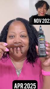 Can we take a moment and admire this GROWTH?! 😍, Our Microlocs Hydrating  Growth Oil provides:, ✅ Deep Hydration: Penetrates and moisturizes  microlocs, preventing dryness and brittleness., ✅ Hair ...