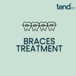Dental Braces Treatment in Jubilee Hills, Hyderabad product image