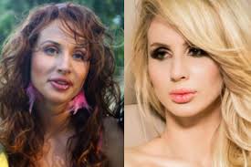 Maybe you would like to learn more about one of these? Svetlana Loboda Pevica Do I Posle Plastiki Foto Umnica Krasavica