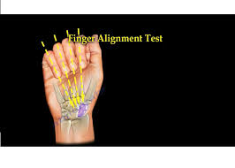 Image result for Hand Exam