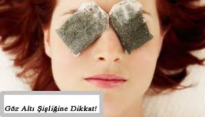 Goz Alti Sisligi Ve Goze Etkileri Optik Gazete