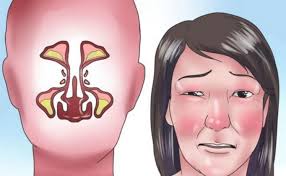 Mungkin karena terlalu sering menggunakan daun ini maka anda ingin menanamnya sendiri. Petua Hilangkan Resdung Dan Hidung Tersumbat Yang Cukup Berkesan 8 Petua
