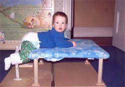 Spica Cast Information Massgeneral Pediatric Orthopaedic Service It Cast Pediatrics Developmental Dysplasia Of The Hip