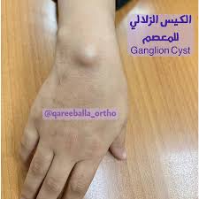 Unique Orthopaedic Posts Facebook