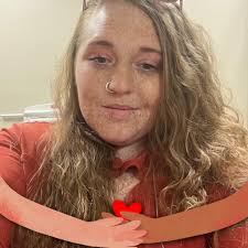 Anyone else have ribs that consistently go out of place(specifically 3rd  rib). I've been trying exercises to work the pec and thoracic spine muscles  and k-tape. But that's not enough. Needs fixed