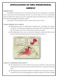 Bed without headboard or footboard namenda titration. Procedure 400 Respiratory System Mucus
