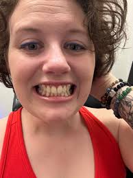 Six Month Follow-Up Visit at The Piper Clinic